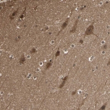 NBP1-90337 - 14-3-3 protein theta